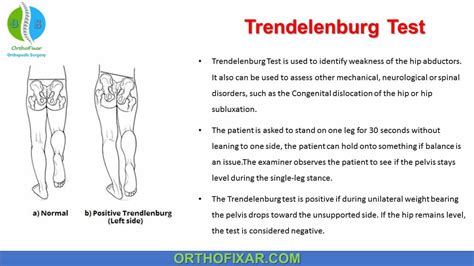 trendelenburg vs hip drop test|how to perform trendelenburg test.